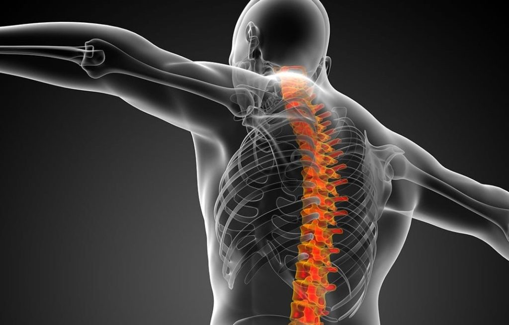 Chronic Complications of Spinal Cord Injury